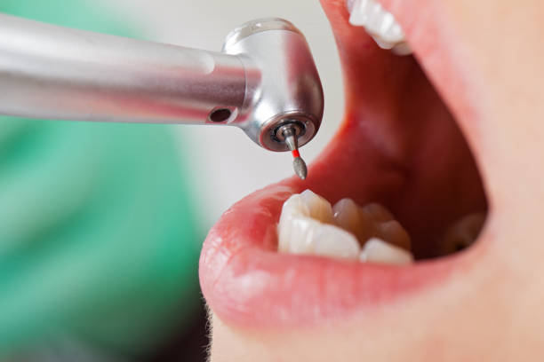 Best Emergency TMJ Treatment in Milton, LA